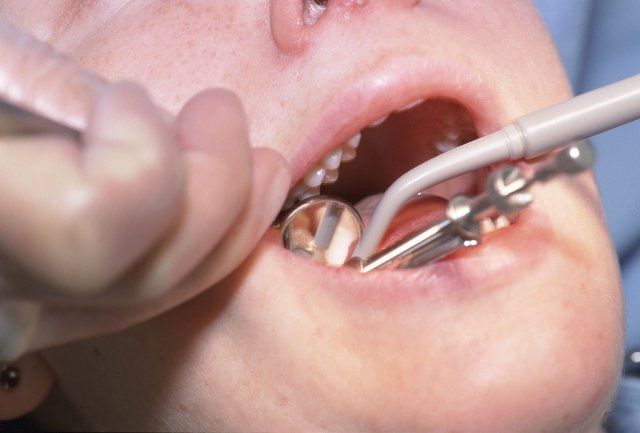Regeneración ósea dental