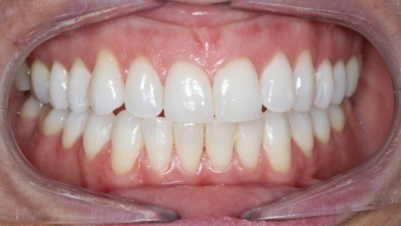 Periodoncia en Villaviciosa