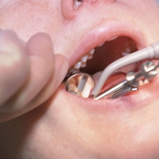 Regeneración ósea dental