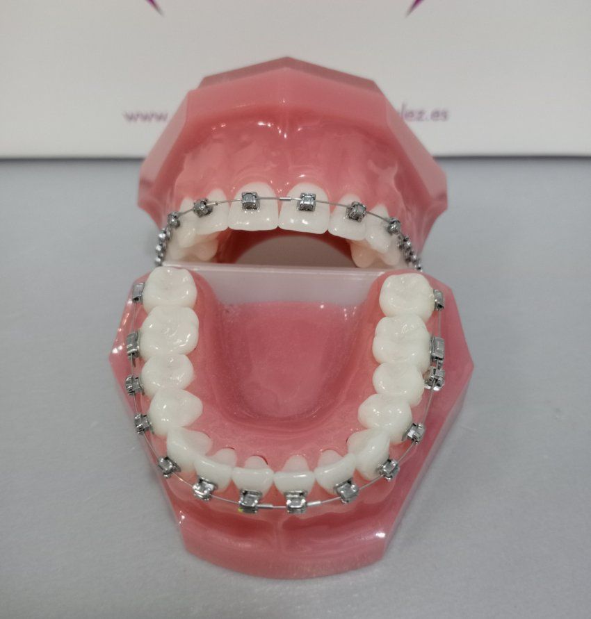 Ortodoncia para adultos en Villaviciosa de Odón | Clínica Dental Sánchez González