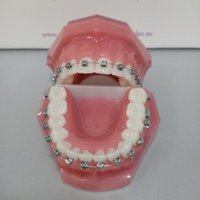 Ortodoncia para adultos en Villaviciosa de Odón | Clínica Dental Sánchez González