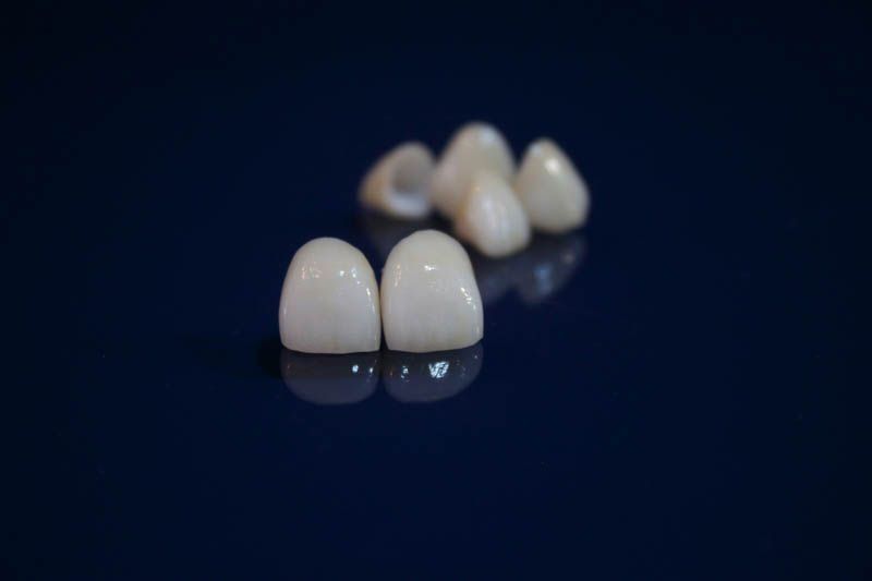 Prótesis dentales Fuenlabrada