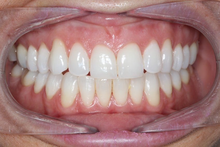 Periodoncia en Villaviciosa Periodoncia en Villaviciosa