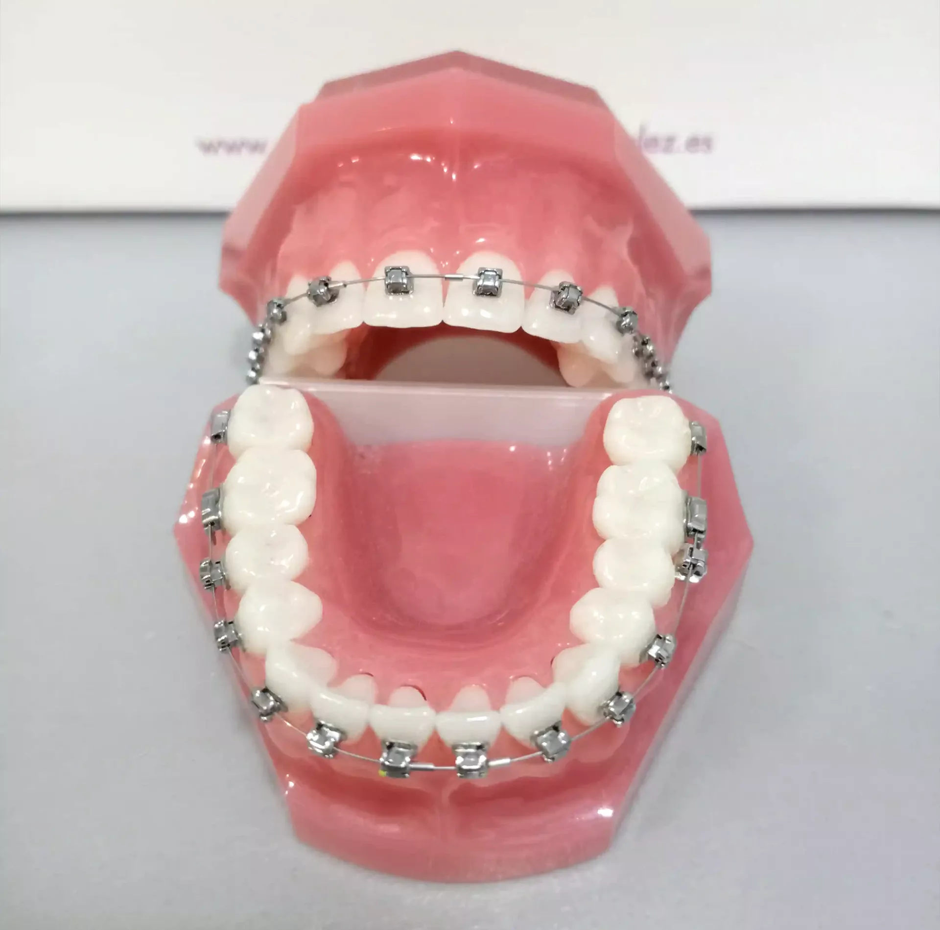 Brackets puestos en un una dentadura falsa